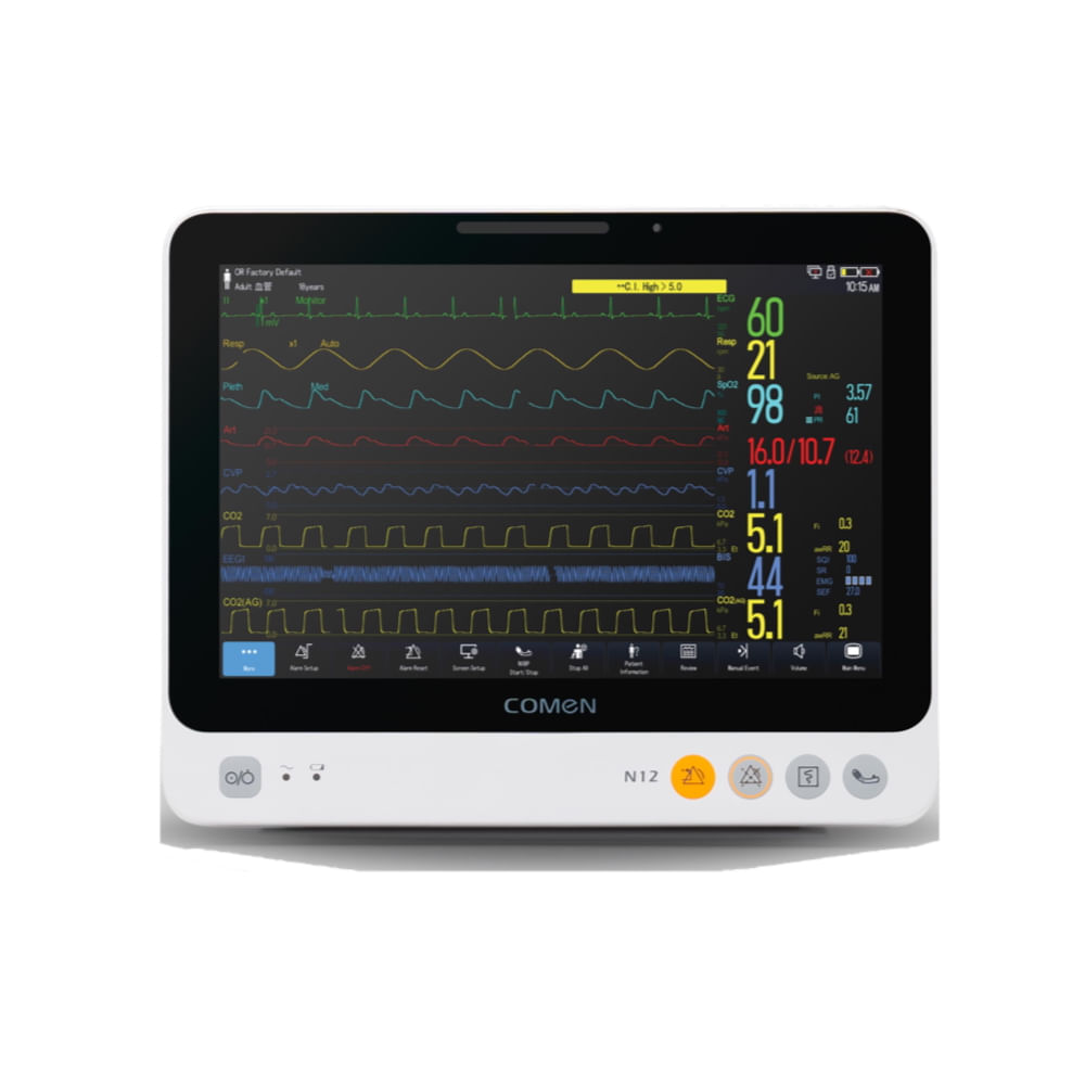 Monitor de paciente de 5 parámetros Comen ND12 con Pantalla Táctil