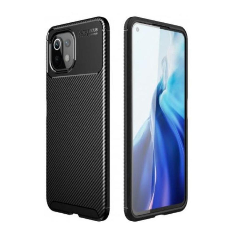 CASE CARBONO AUTOFOCUS XIAOMI MI 11 LITE