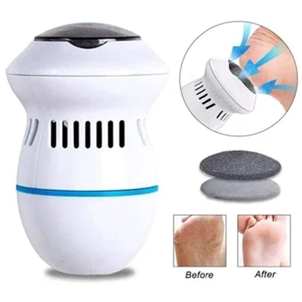 Removedor de Callos Recargable