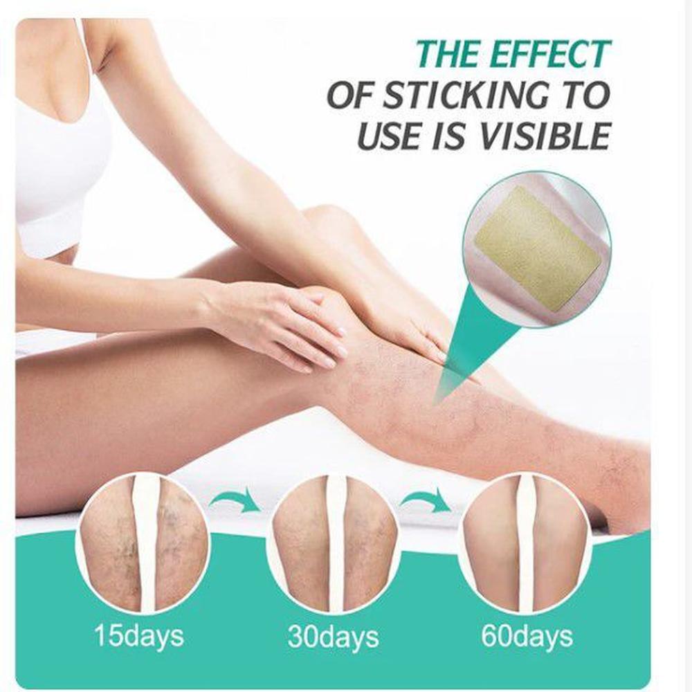 parche de tratamiento de varices