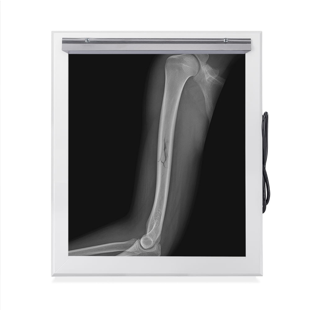 Negatoscopio Fluorescente de 1 Campo en Acero Pintado