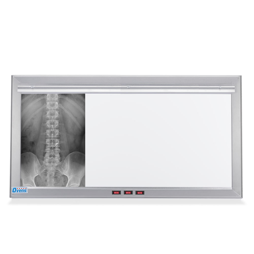 Negatoscopio LED de 3 Campos en Acero Satinado