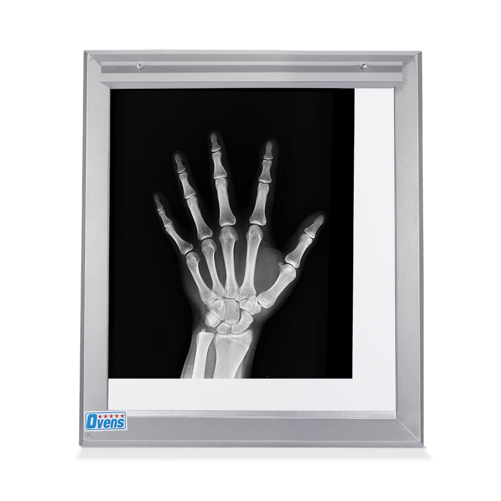 Negatoscopio Fluorescente de 1 Campo en Acero Integro