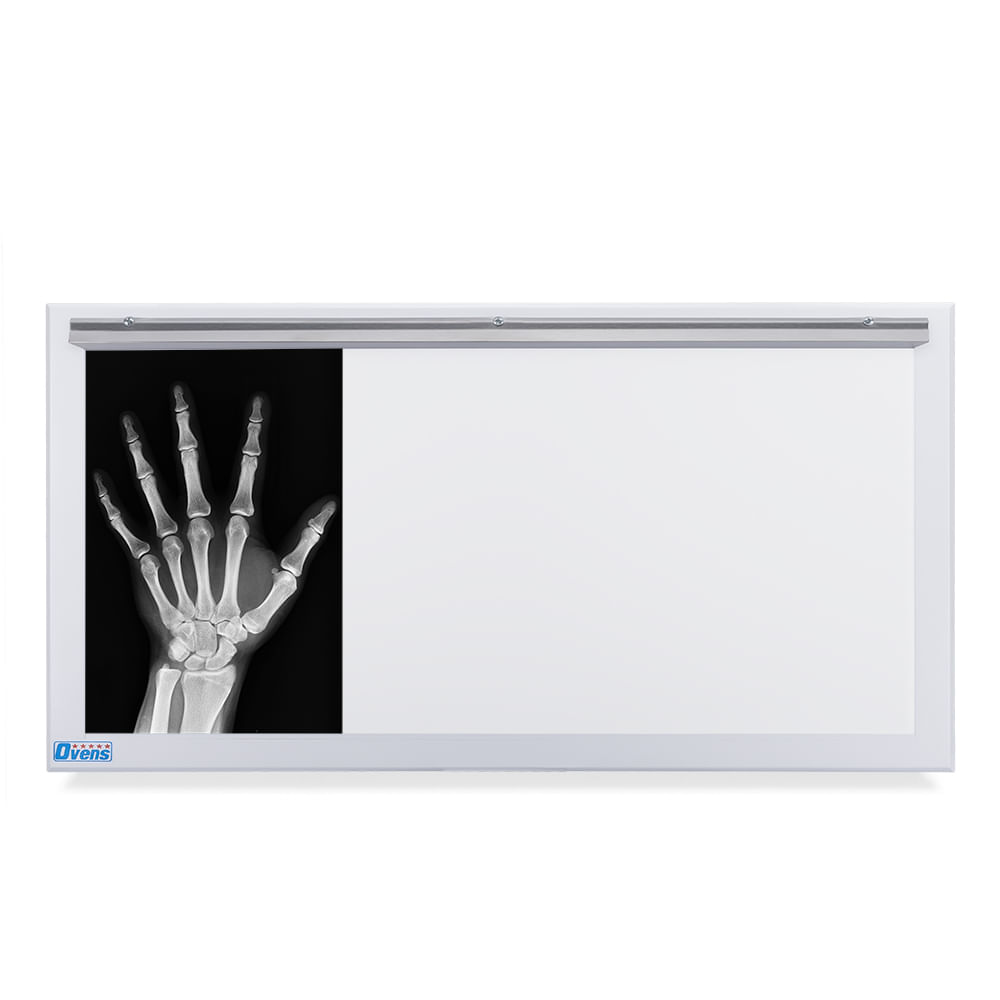 Negatoscopio Fluorescente de 3 Campos en Acero Pintado