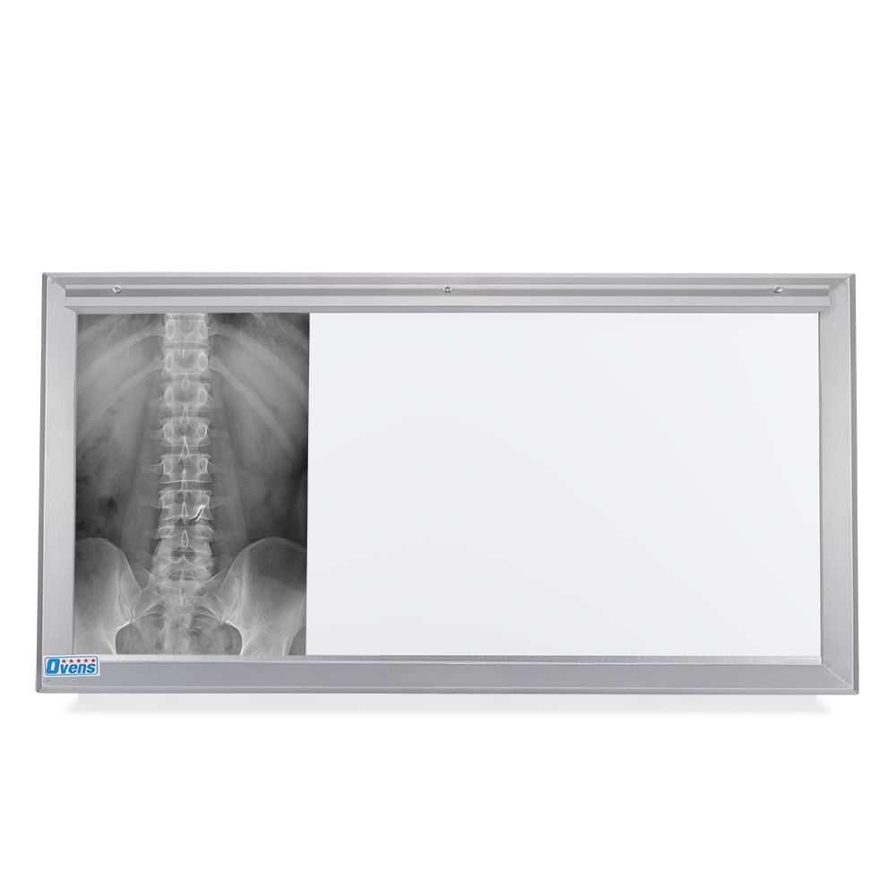 Negatoscopio Fluorescente de 3 Campos en Acero Integro