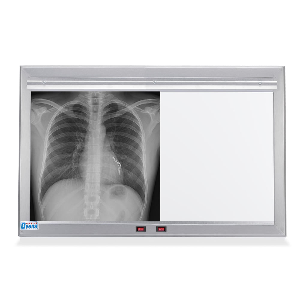 Negatoscopio LED de 2 Campos en Acero Satinado