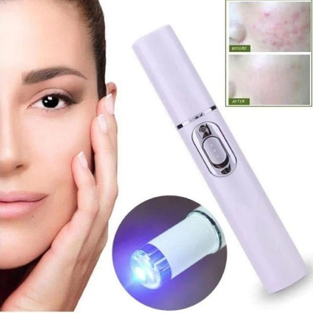 Laser Lápiz Luz Azul Hot Tonificador Acné Marcas de Acné Piel Genieka Laser Lápiz Luz Azul Hot Tonificador Acné Marcas de Acné Piel Genieka