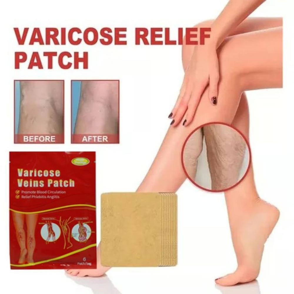 3Sobre 18Parches Varicose para Varices Elimina Vena Hinchada Multicolor 3Sobre 18Parches Varicose para Varices Elimina Vena Hinchada Multicolor