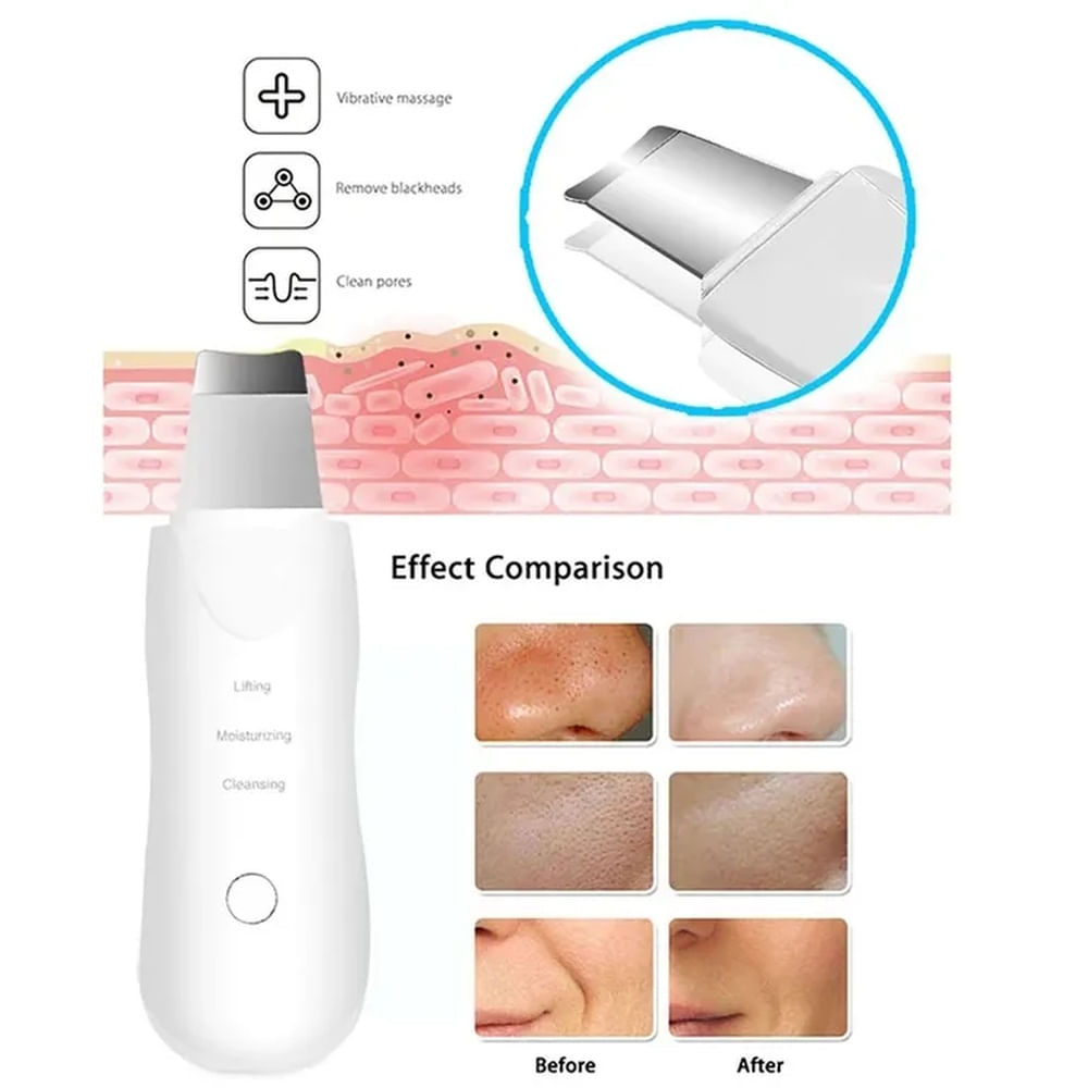 Limpiador Facial Espátula Ultrasónico Limpieza Profunda Portatil